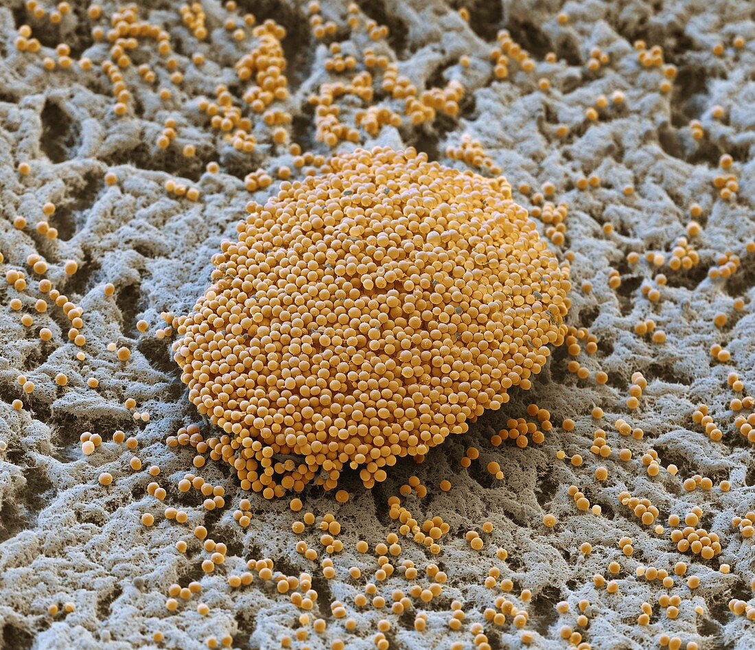 Myxococcus xanthus 1500x - Myxococcus Xanthus, Kolonie, 1500-1