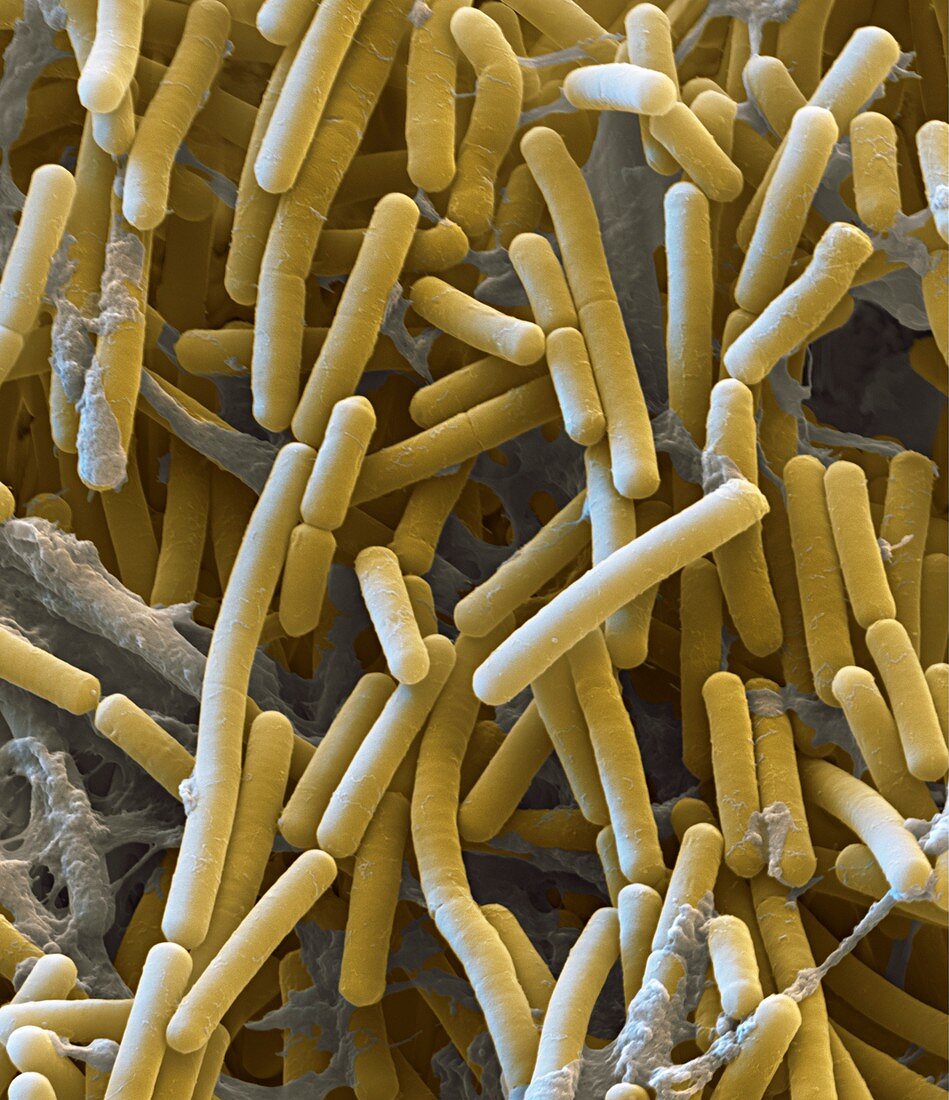 Clostridium botulinum bacteria, SEM