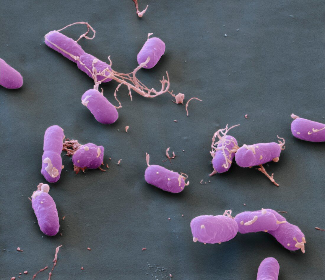 Yersinia pestis 17kx - Bakterien, Pesterreger, Yersinia pestis 17 000-1