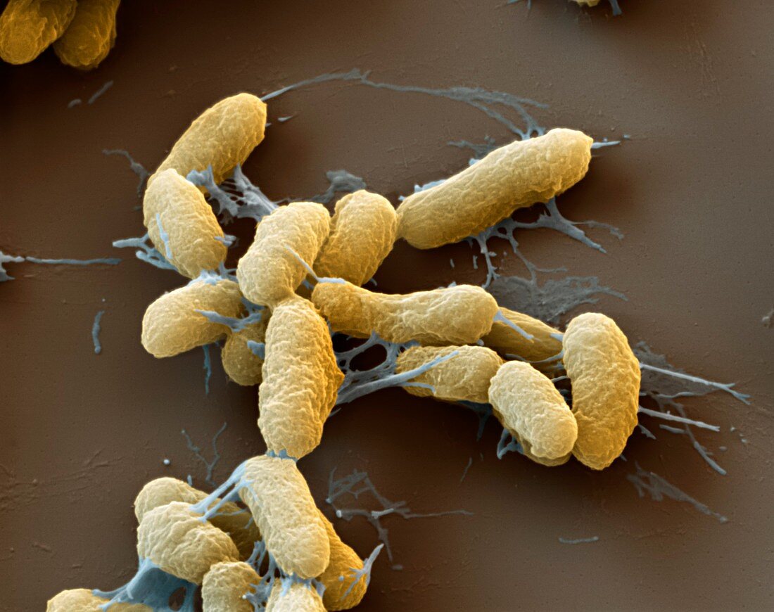 Plague Bacteria Yersinia Pestis Sem Acheter Une Photo 12526508 Science Photo Library