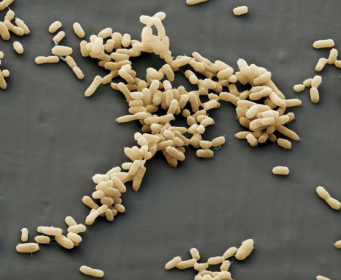 Yersinia pestis 6kx - Bakterien, Pesterreger, Yersinia pestis 6000-1