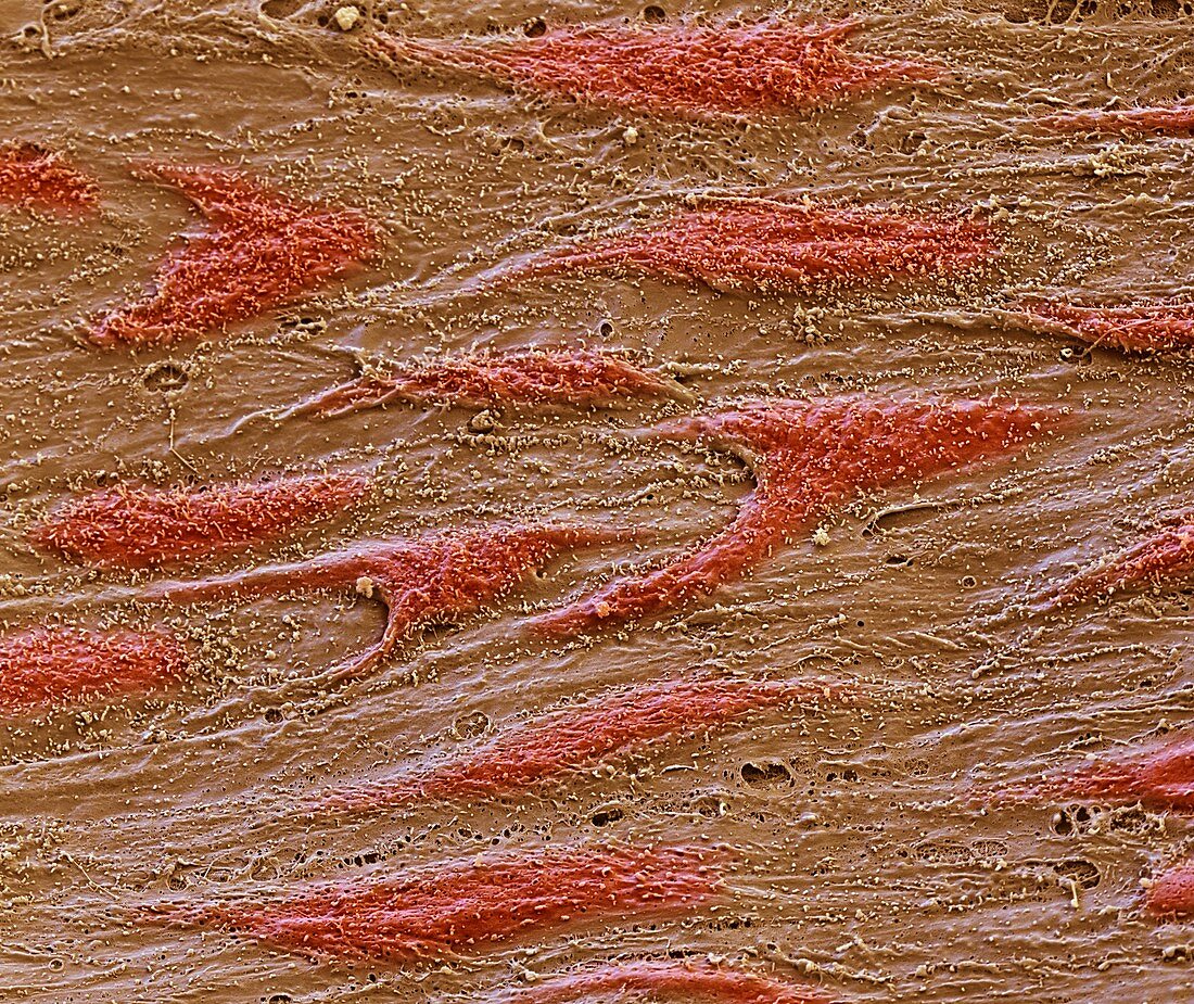 Endothel Aorta 2000x - Endothel der Aorta 2000-1