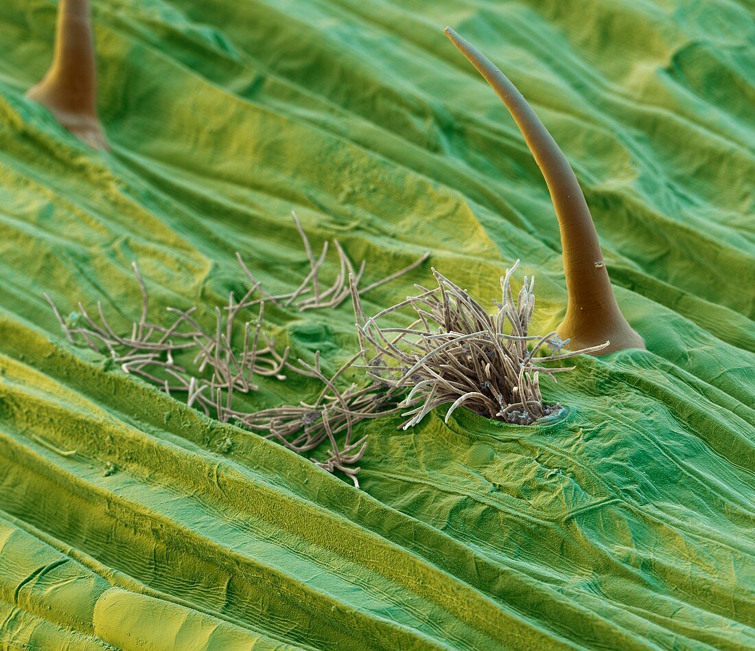 Septoria leaf blotch infection, SEM