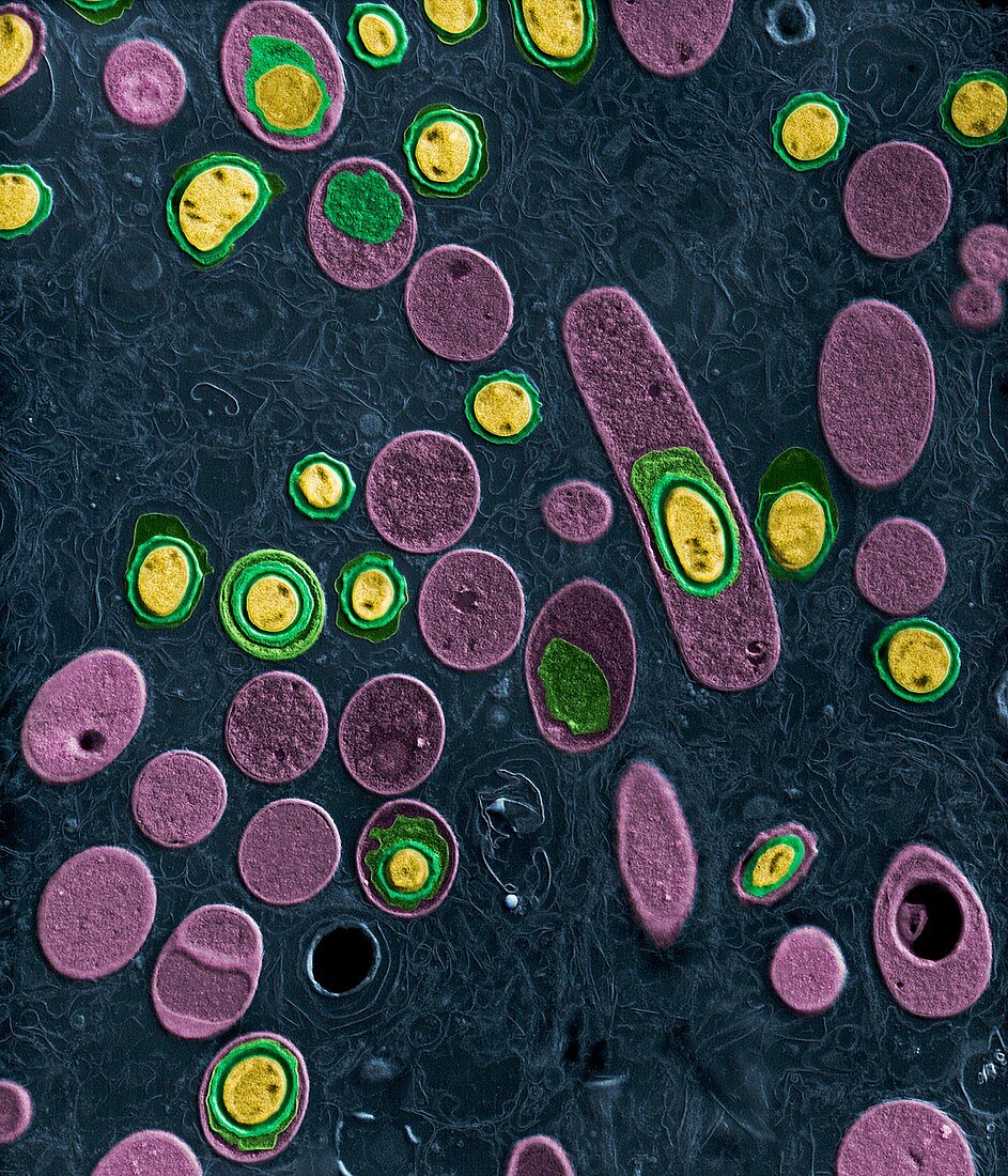 Bacillus anthracis, Milzbrand 10 000:1