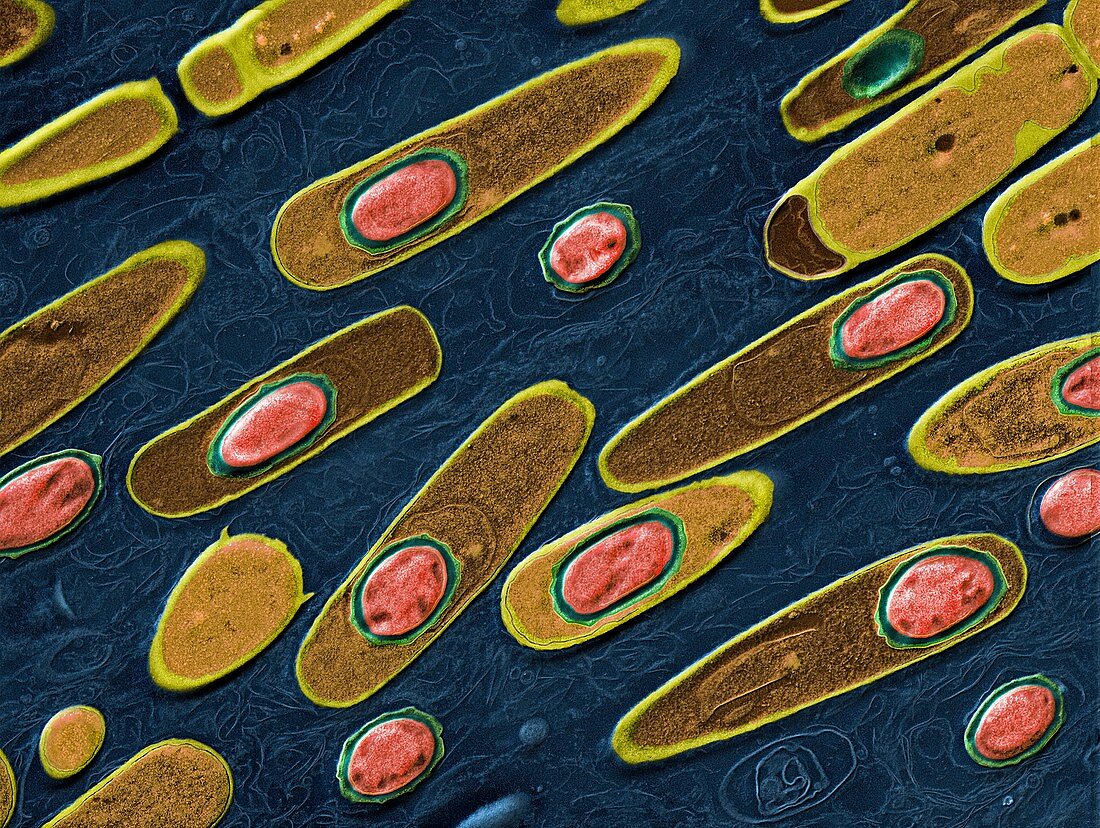 Anthrax bacteria, TEM