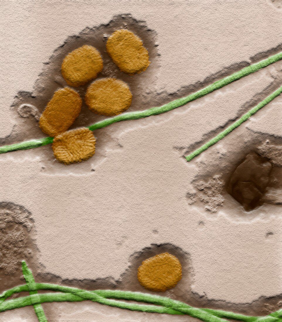 Molluscum contagiosum virus, TEM