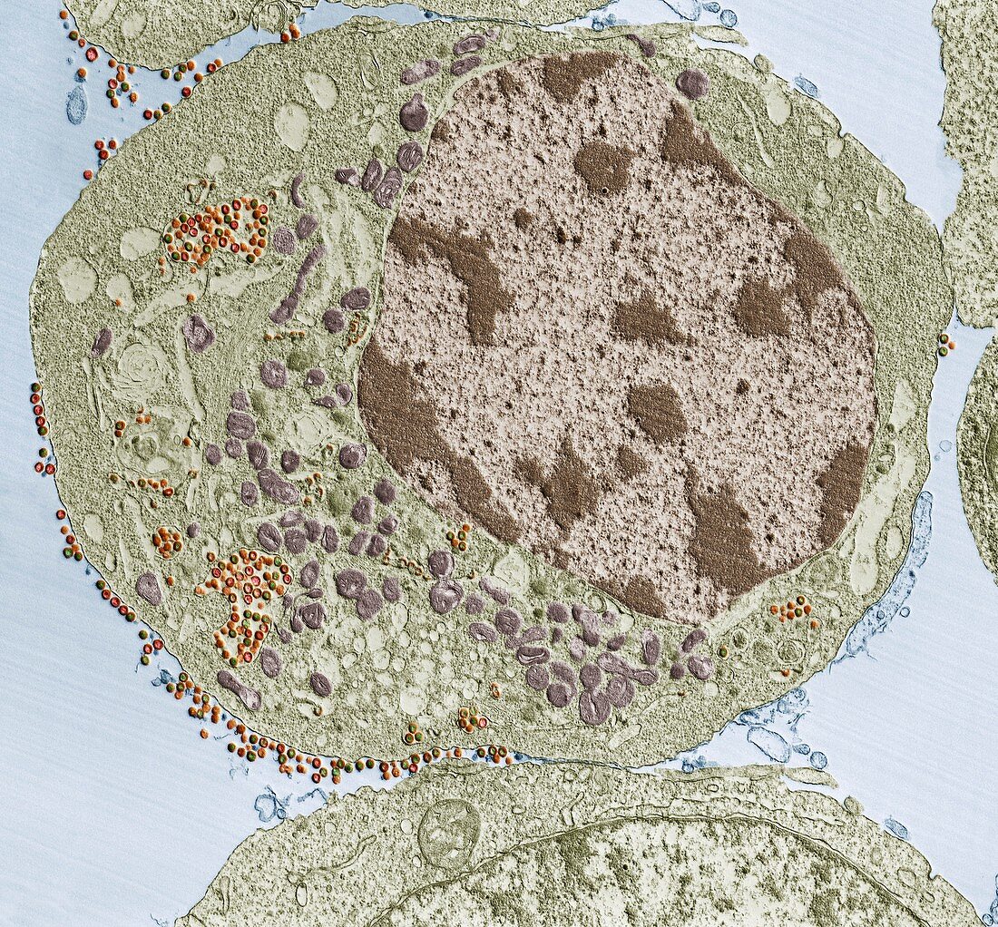 HIV infected cell, TEM