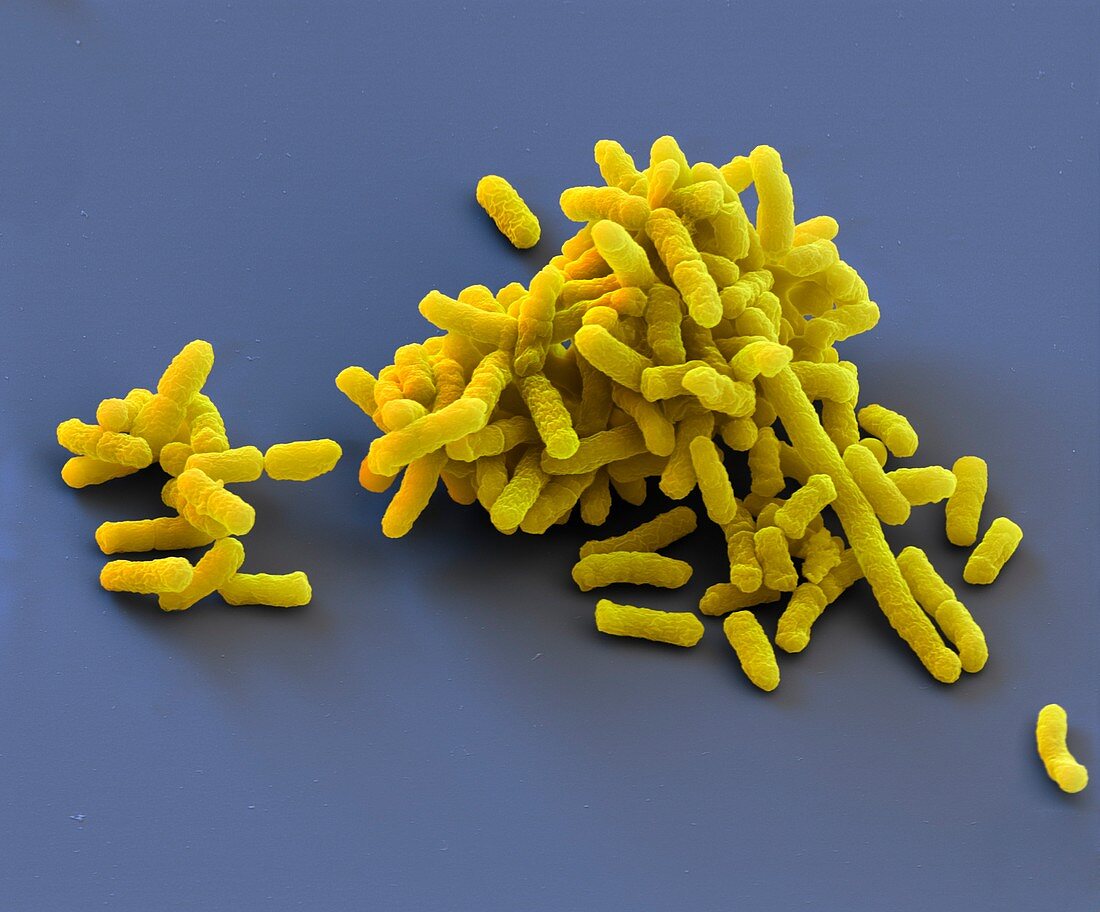 Klebsiella pneumoniae bacteria, SEM
