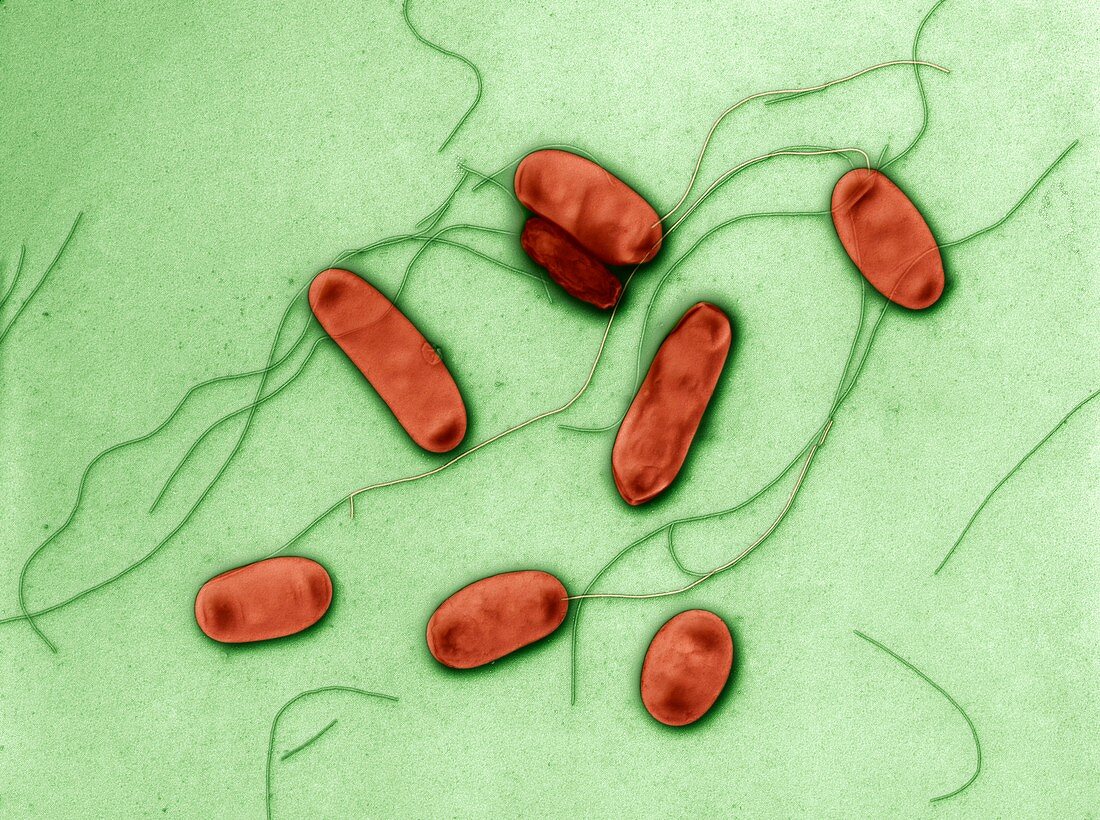 Legionella pneumophila, 15 000:1