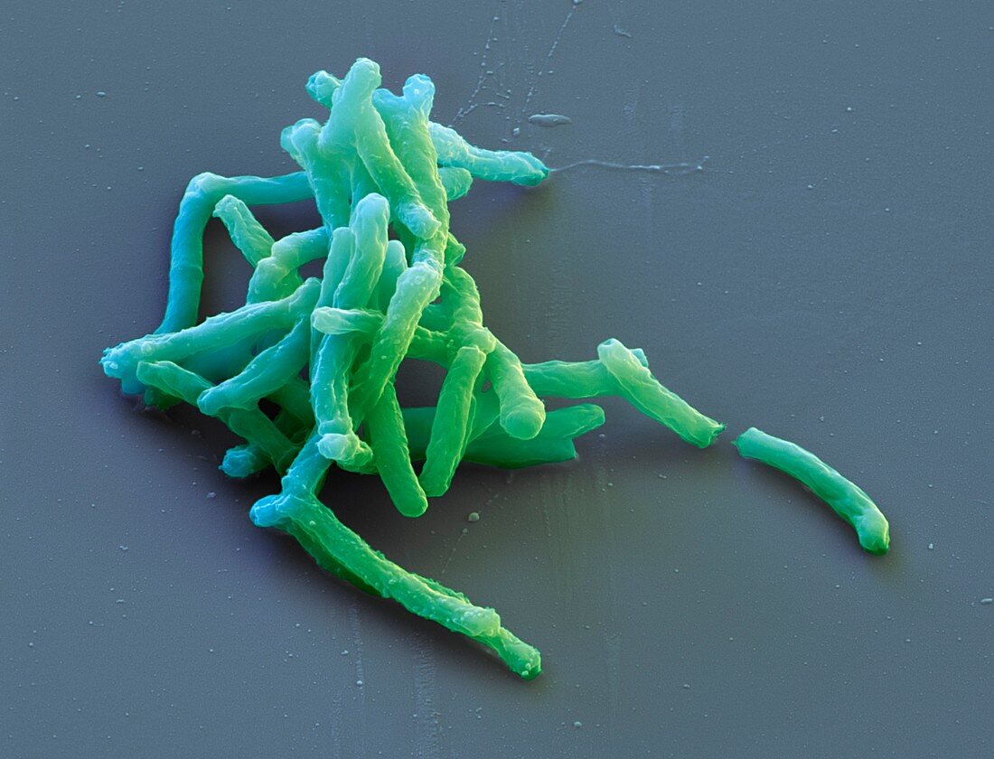 Mycobacterium tuberculosis 13 000:1