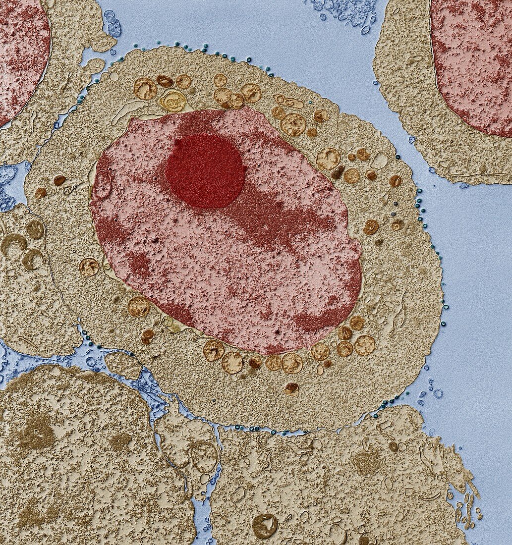Apoptosis of HIV infected cell, TEM