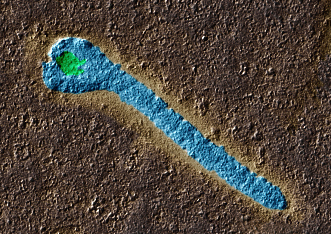 Ebola-Viren 140000x