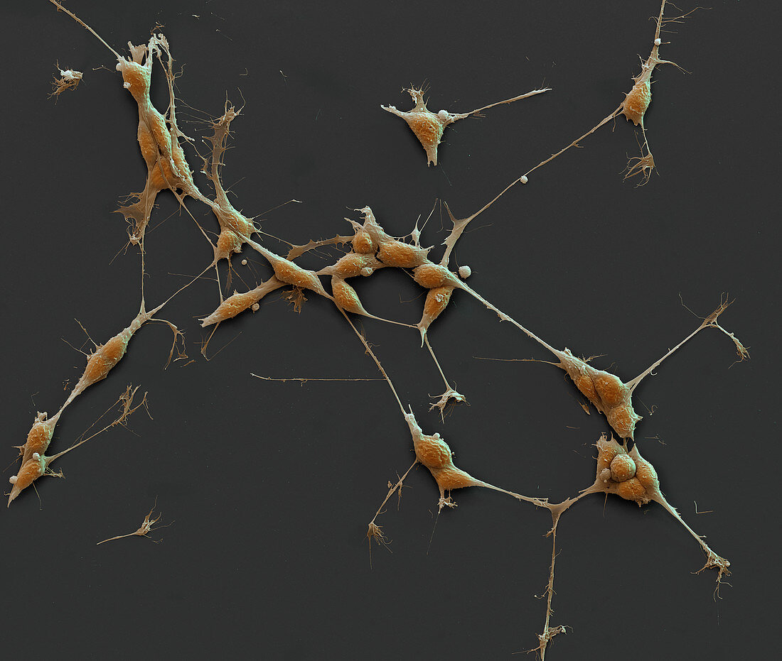 Neuroblastom-Zellen 650:1