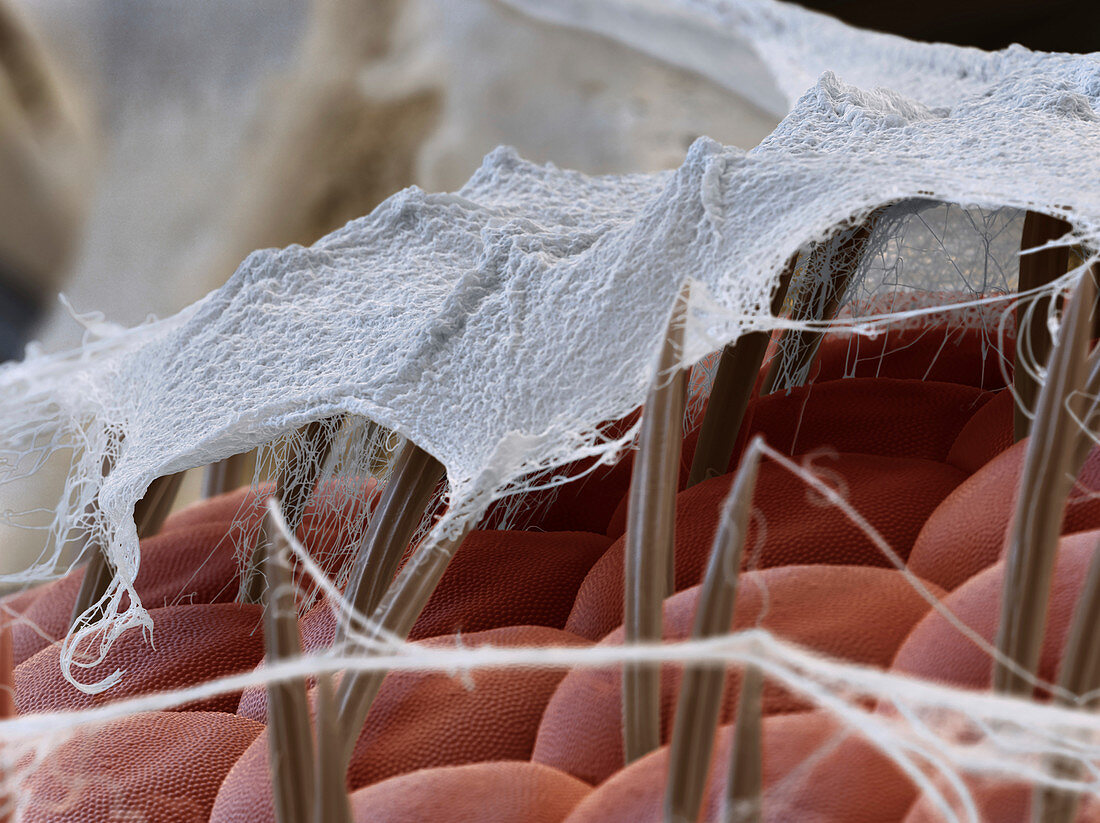 Spider silk on insect prey, SEM