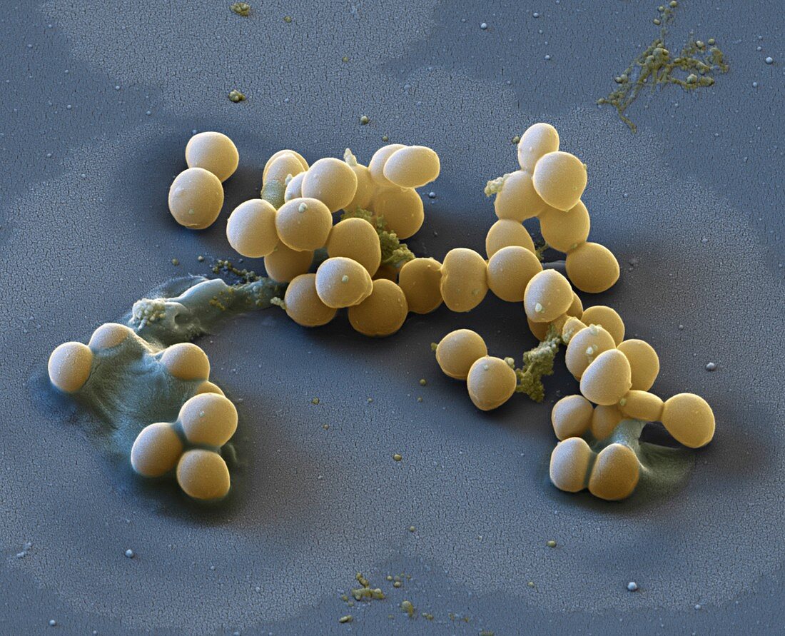 Staphylococcus lugdunensis 18 000:1