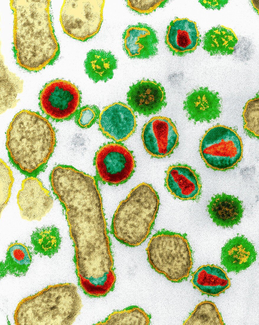 Coloured TEM of HIV viruses, cause of AIDS