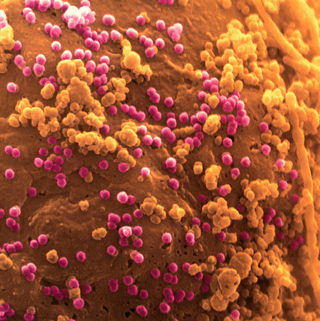 Coloured SEM of a T-cell surface with AIDS viruses