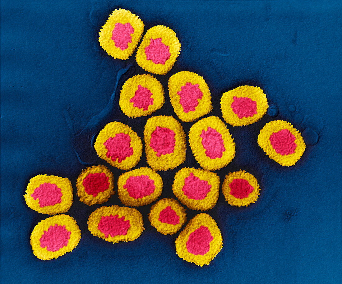 Smallpox viruses, TEM