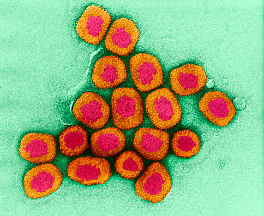 Smallpox viruses, TEM