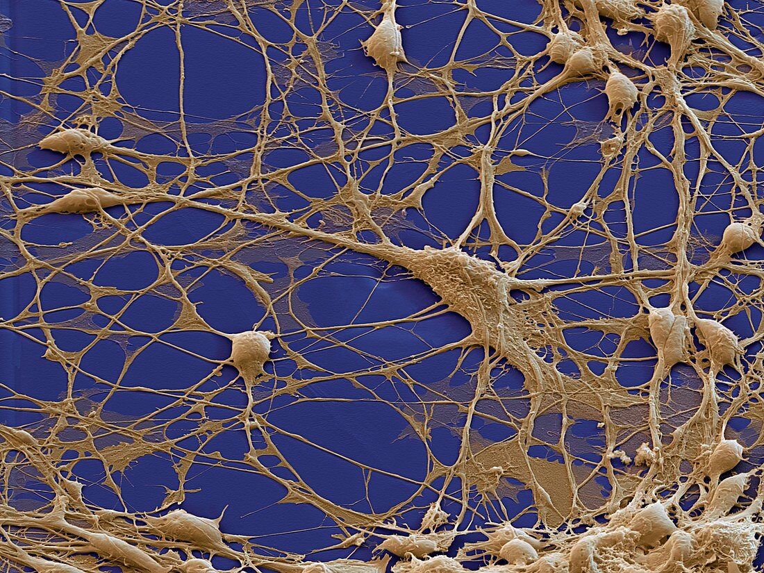 Neuronale Vorlaeuferzelle 1250x - Neuronale Vorläuferzellen, human (Neuronal Progenitor Cells) 1250x 2