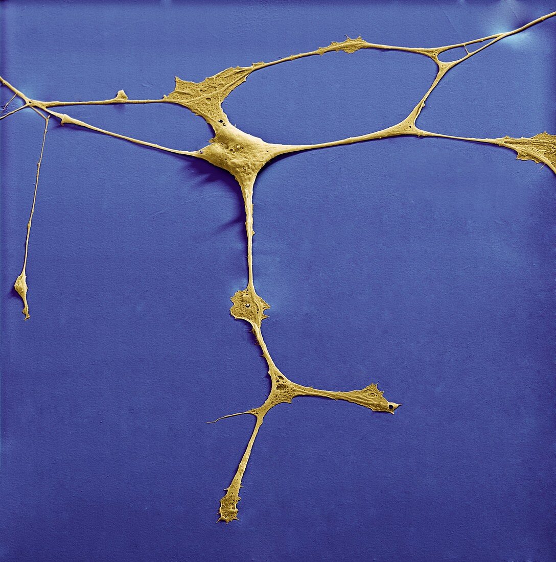 Neuronale Vorlaeuferzelle 1500x - Neuronale Vorläuferzellen, human (Neuronal Progenitor Cells) 1500x