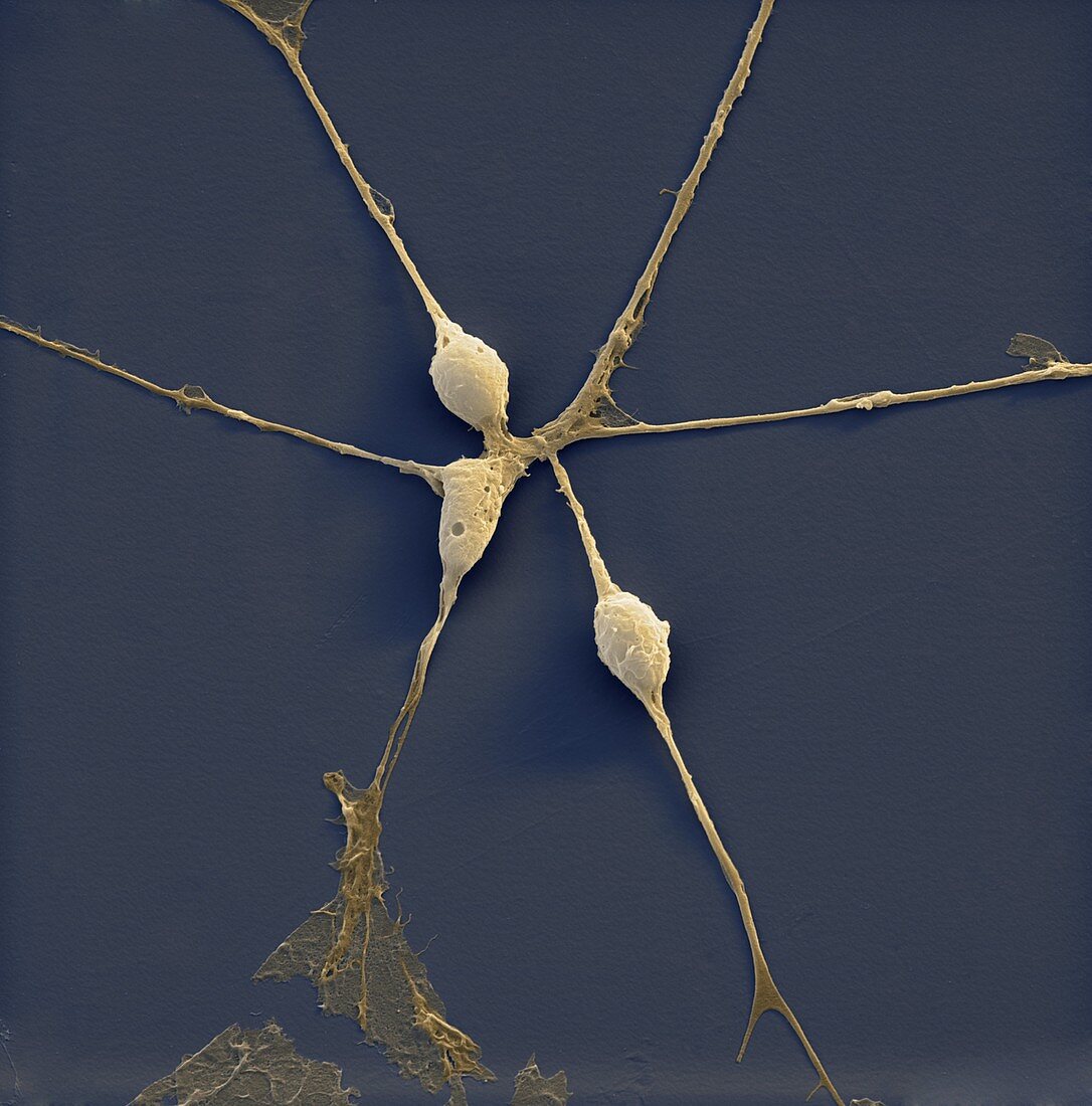Neuronale Vorlaeuferzelle 1900x - Neuronale Vorläuferzellen, human (Neuronal Progenitor Cells) 1900x