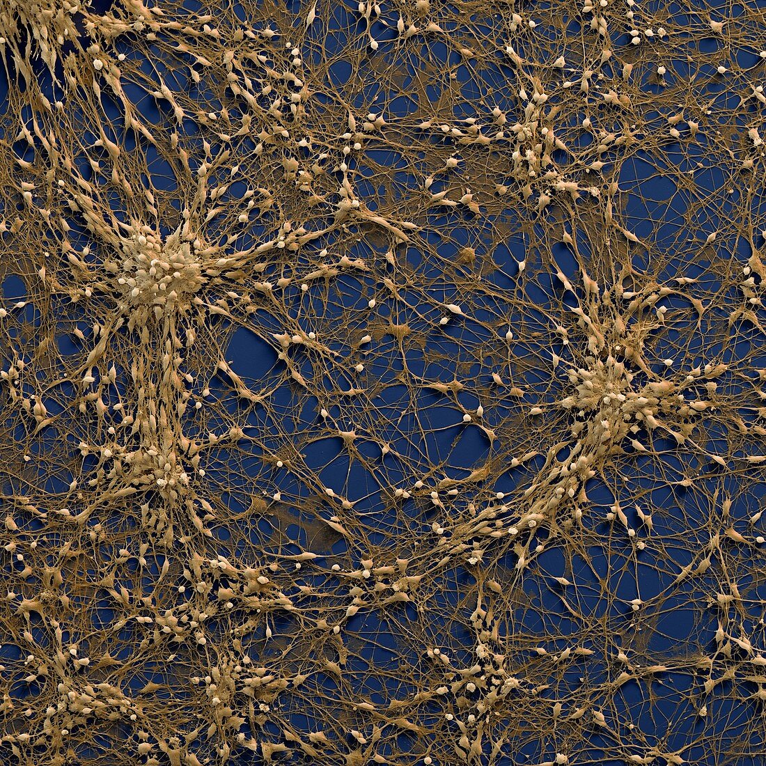 Neuronale Vorlaeuferzelle 240x - Neuronale Vorläuferzellen, human (Neuronal Progenitor Cells) 240x