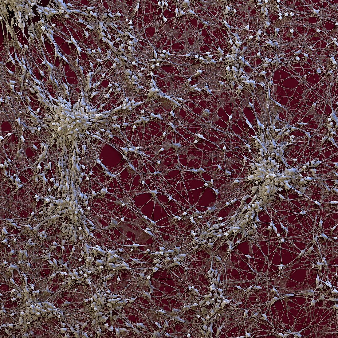 Neural progenitor cells, SEM