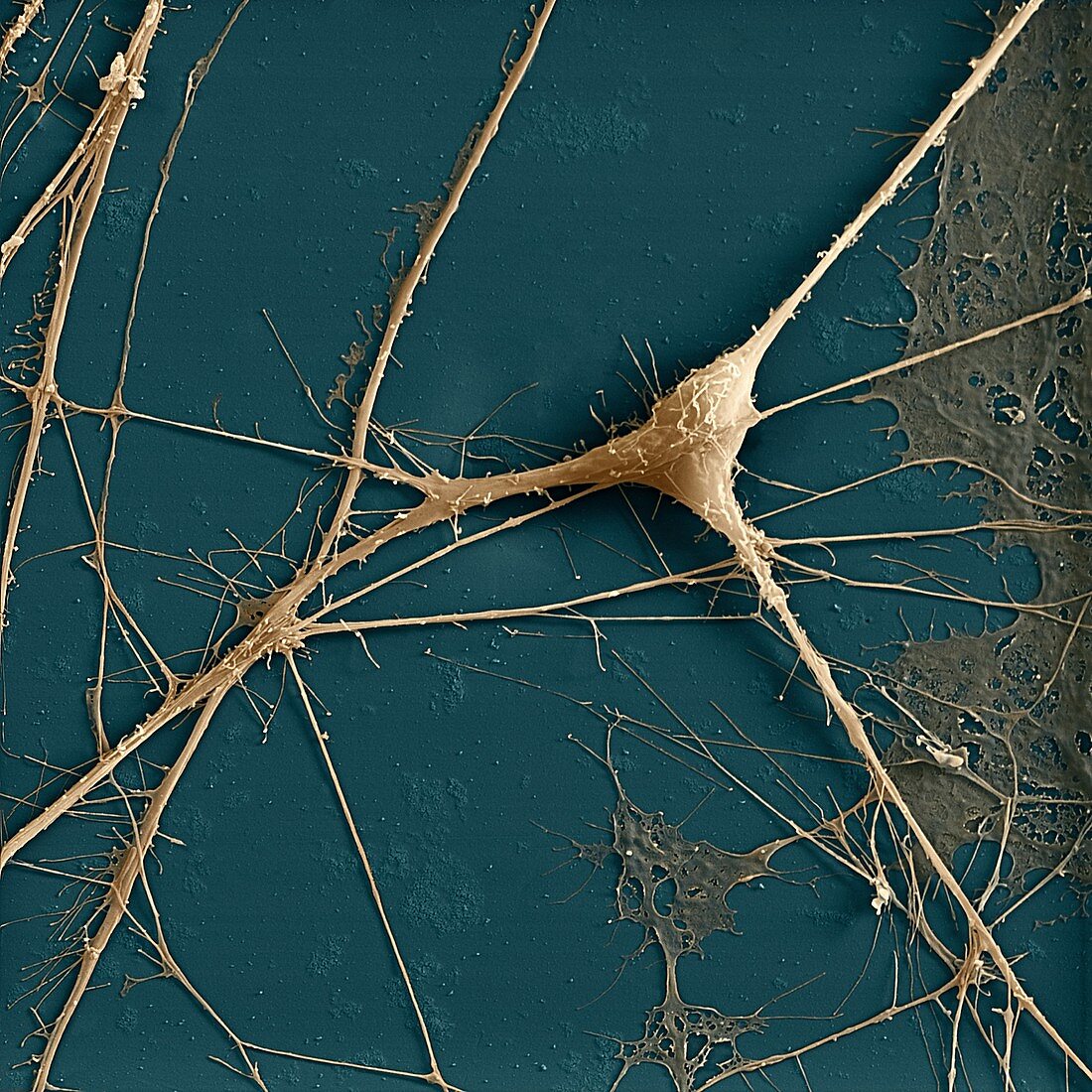Spinal ganglion nerve cells, SEM