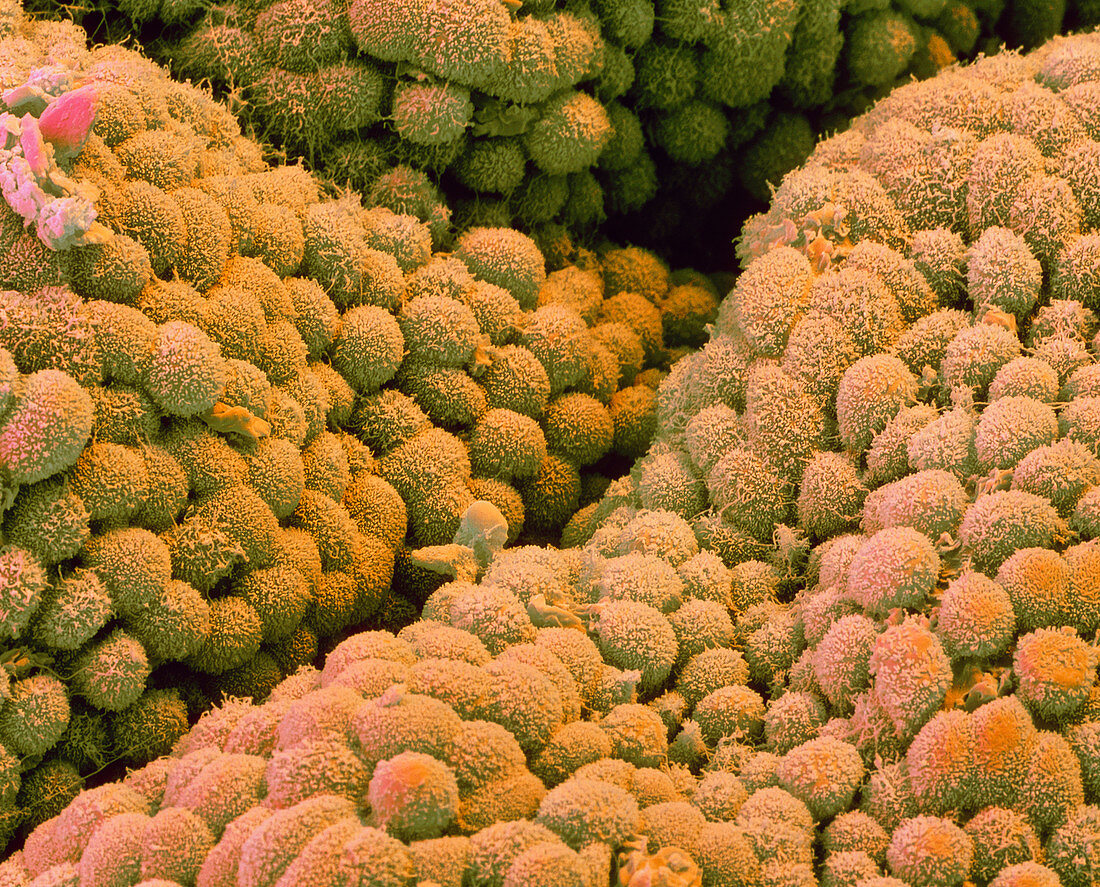 Coloured SEM of surface cells of the gall bladder
