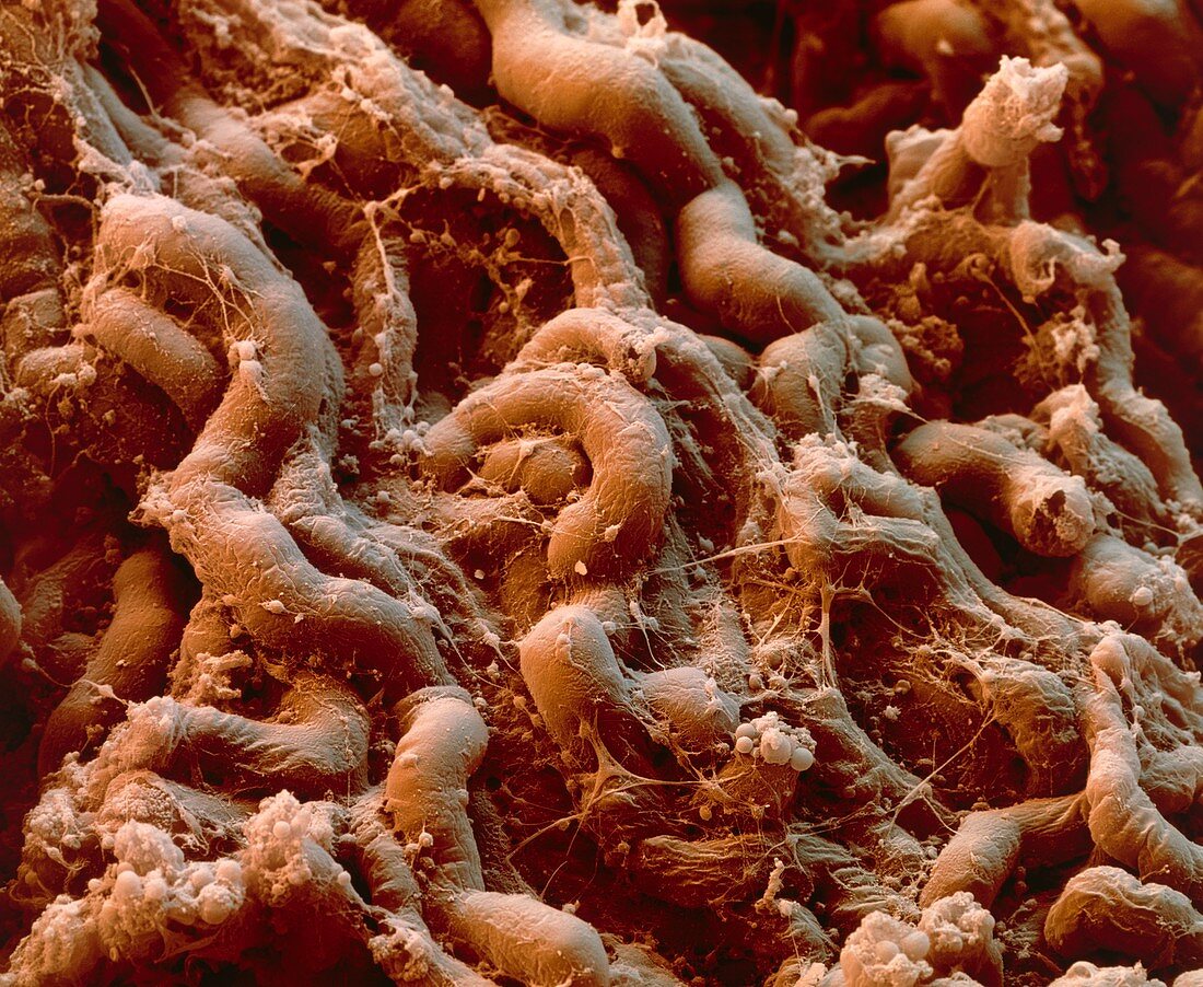 Coloured SEM of tubules in the kidney