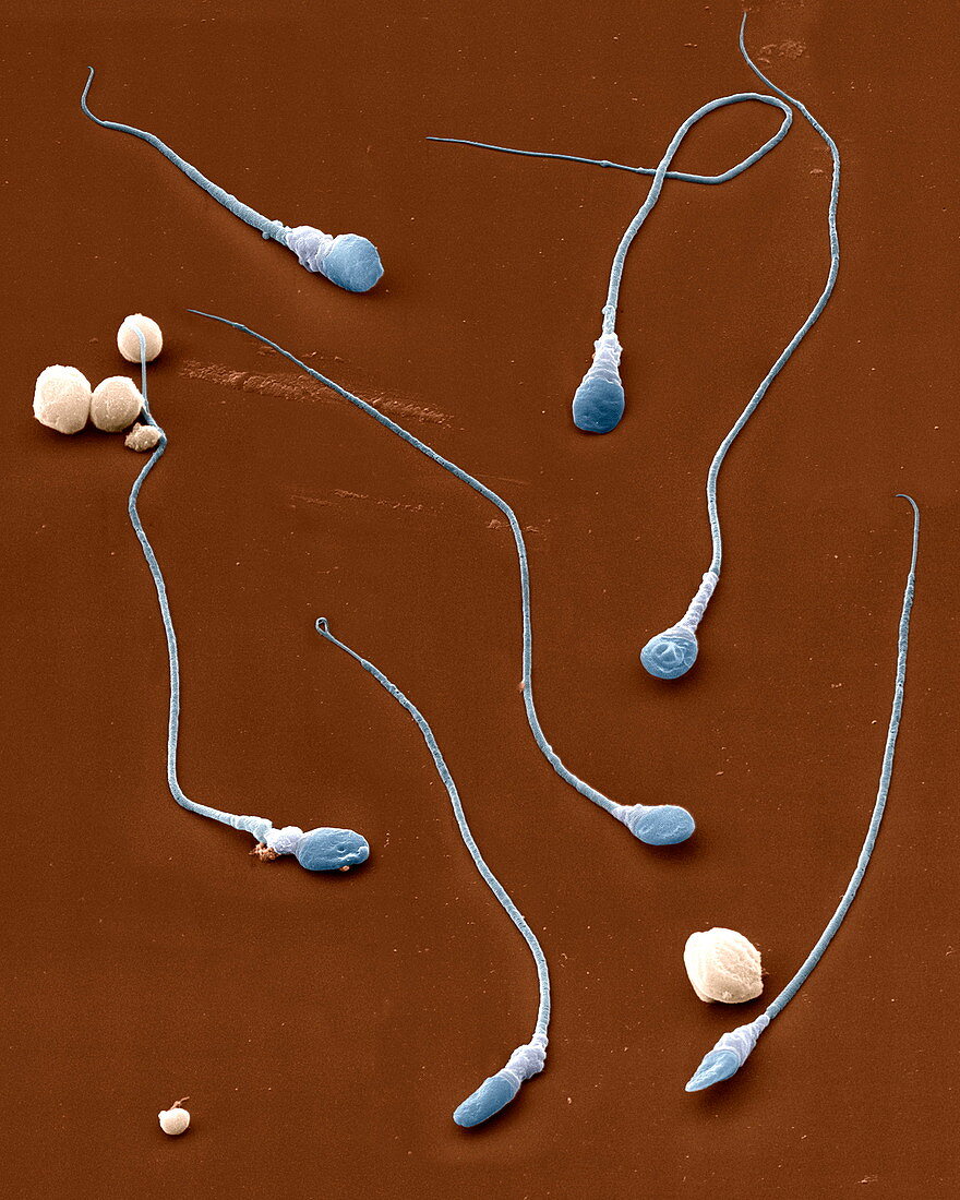 Sperm cells, SEM