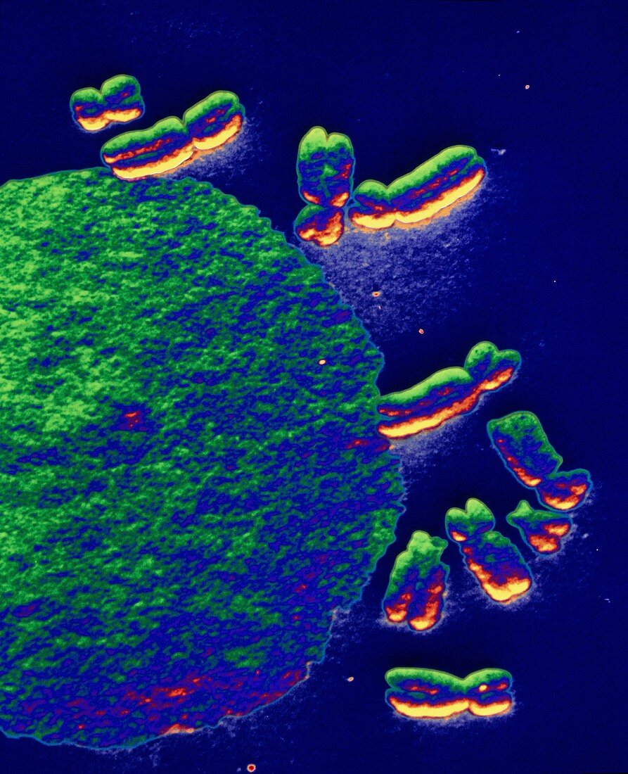 Coloured SEM of a human chromosomes & nucleus
