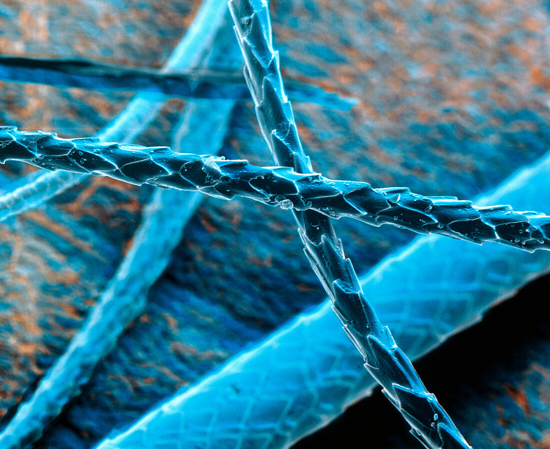 Coloured SEM of cat hairs, a cause of allergy