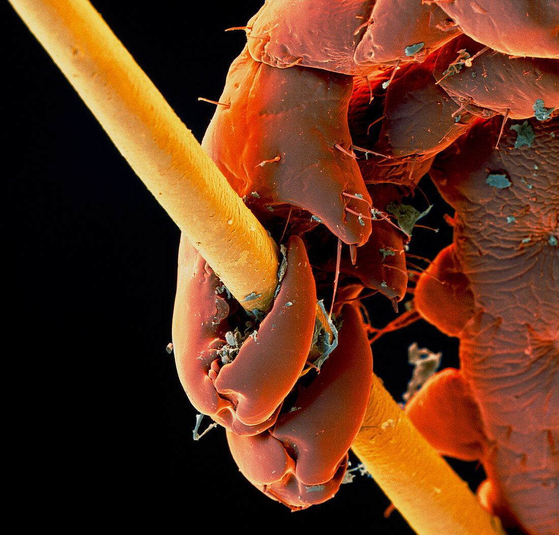 Coloured SEM of a pubic louse claw