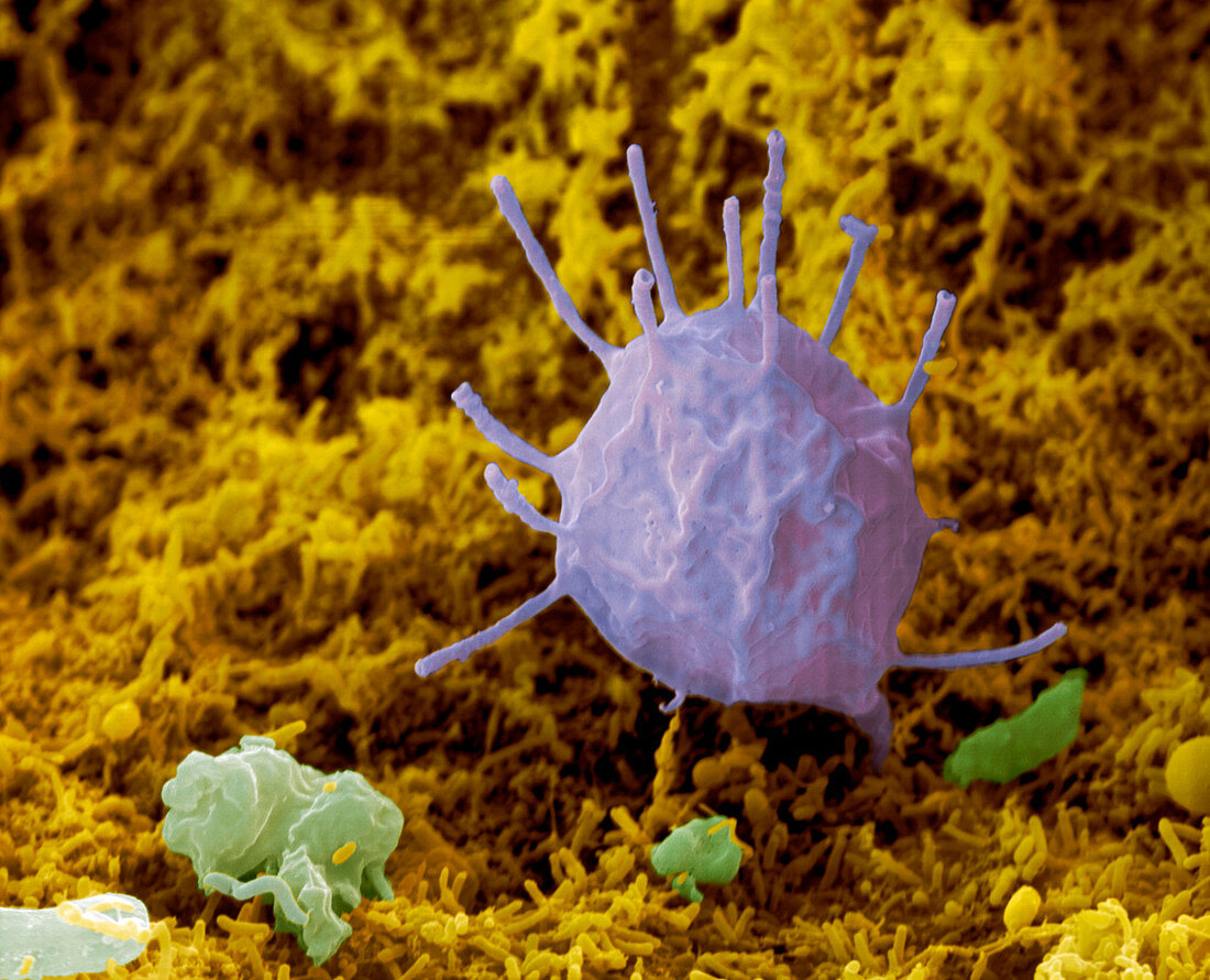 Colour SEM of suctorian ciliate in a compost heap