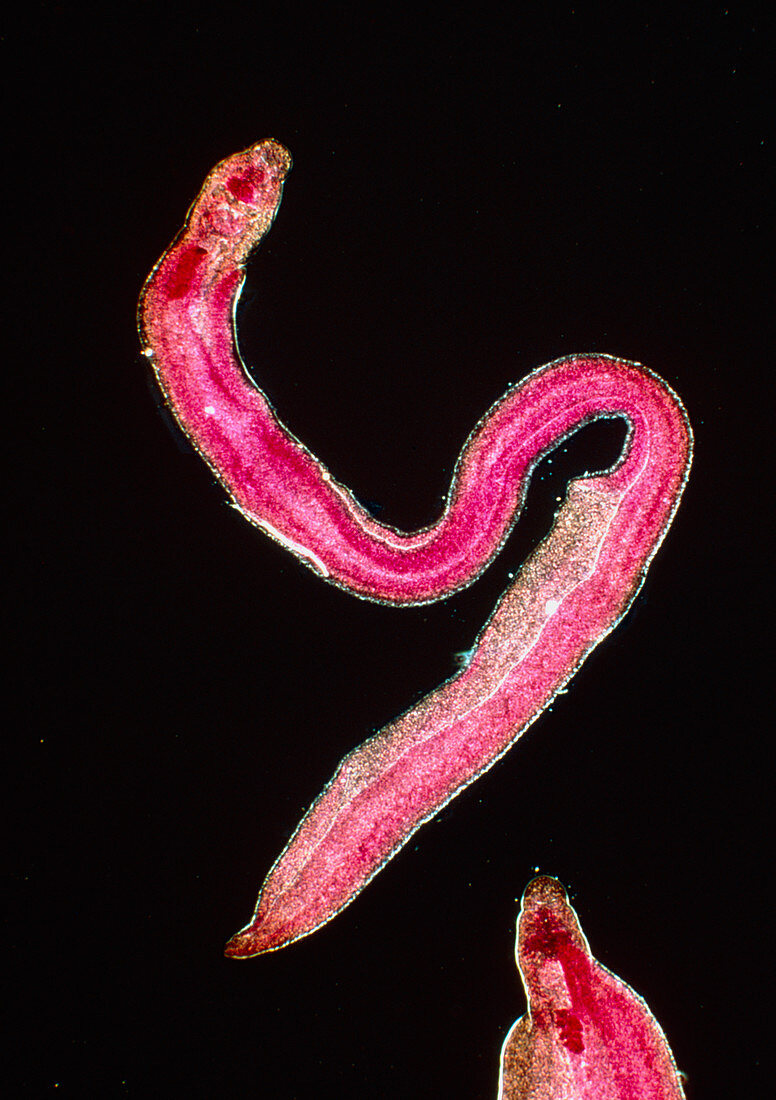 LM of a bilharzia fluke, Schistosoma mansoni