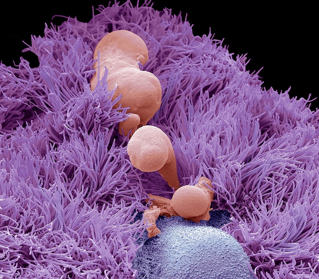 Human airway epithelial culture, SEM