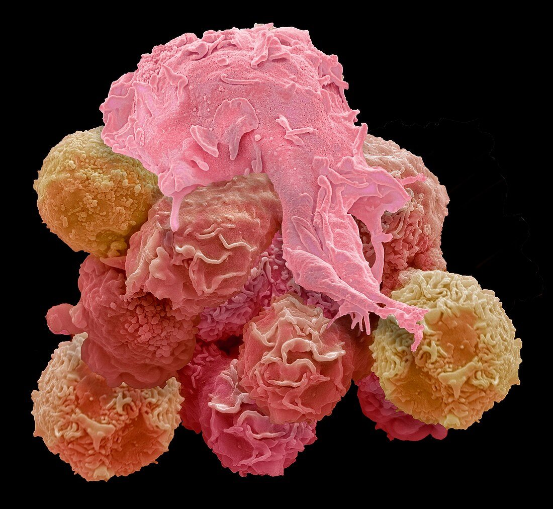 Macrophage and cancer cell, SEM