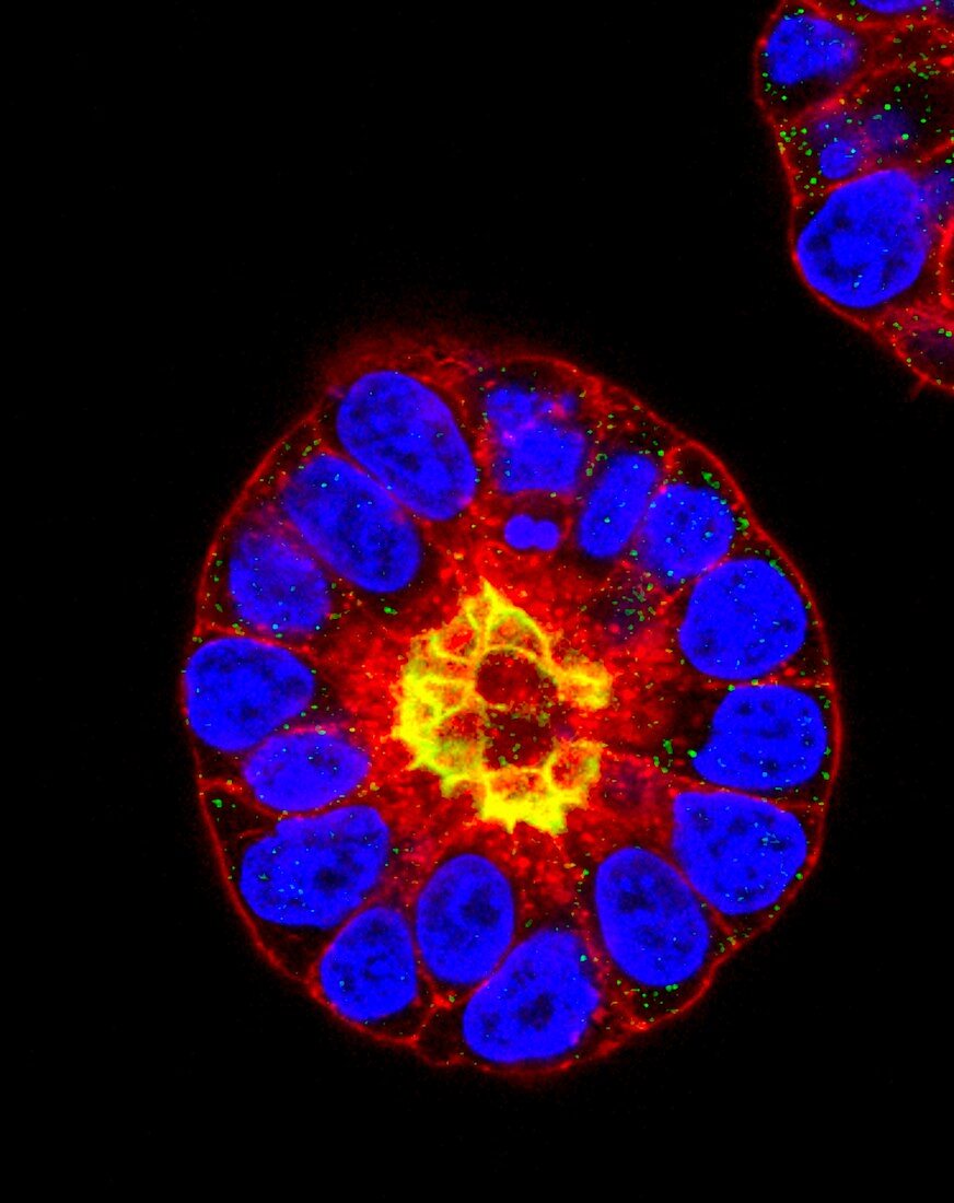 Mouse embryo, fluorescence micrograph