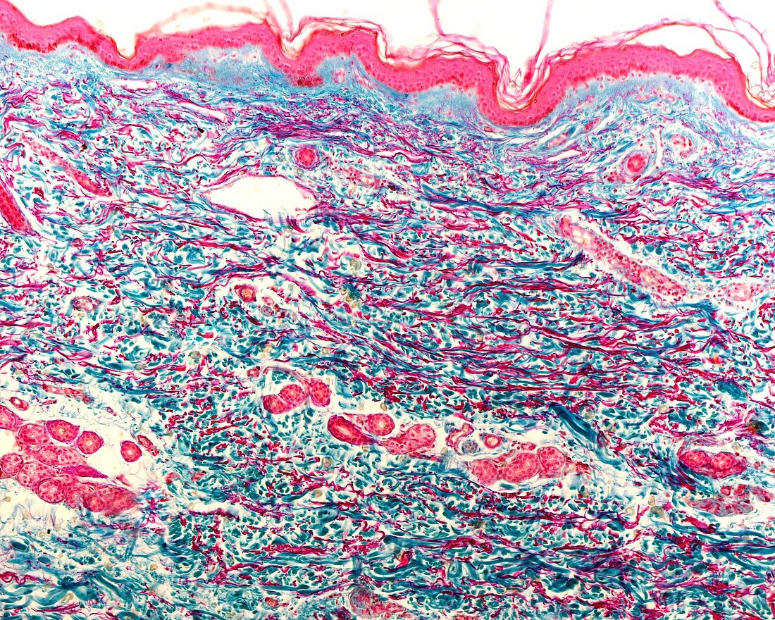 Collagen and elastic fibres, light micrograph