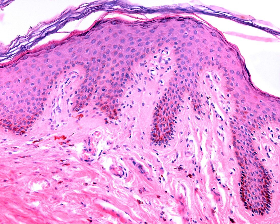 Pigmented skin, light micrograph