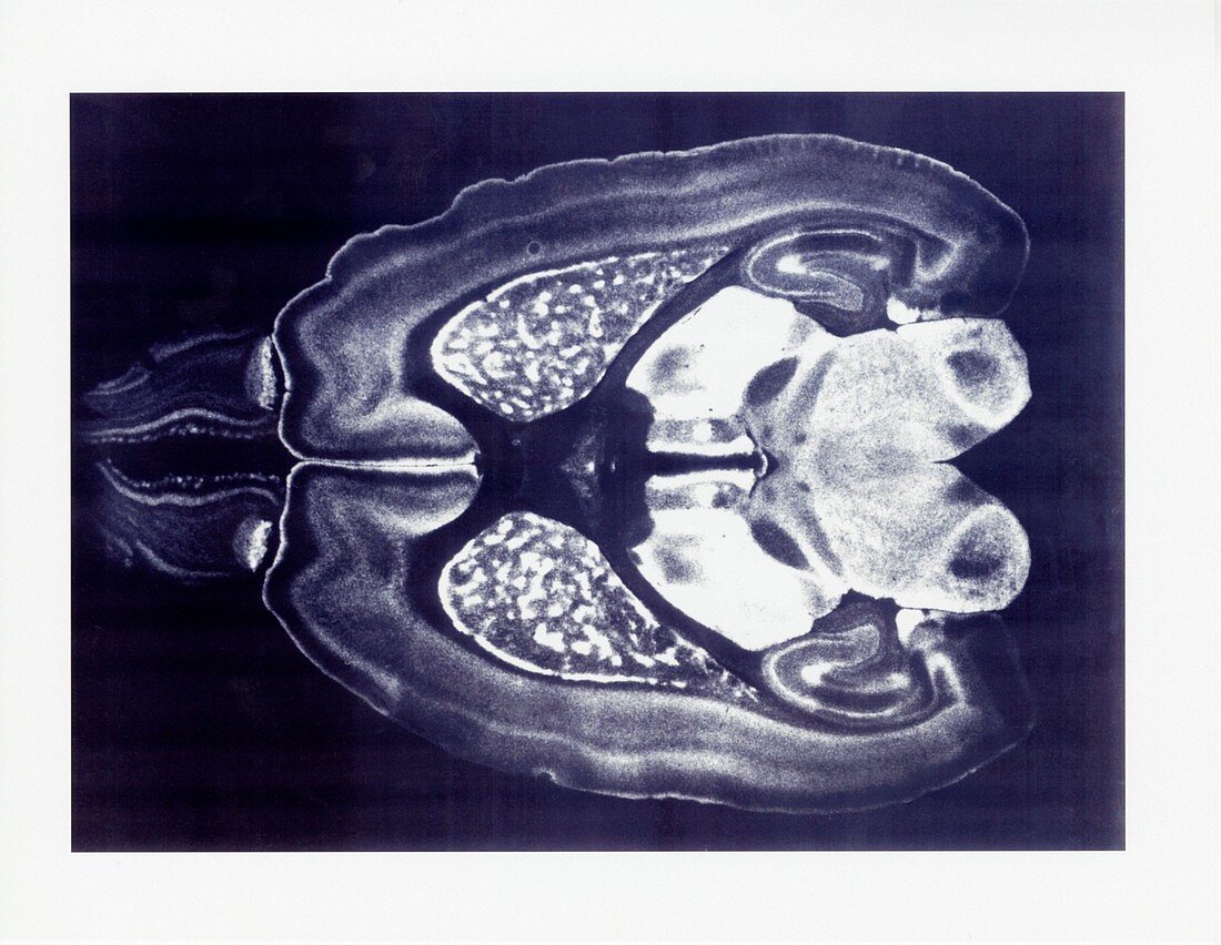 Opioid receptor distribution in rat brain, light micrograph