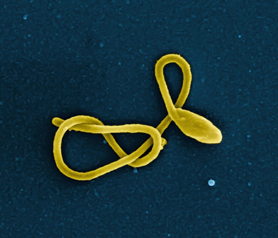 Ebola virus particle, SEM