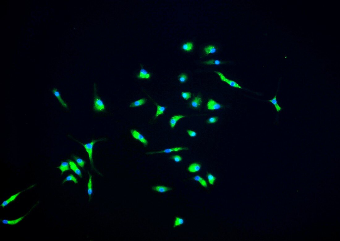 Microglia brain cells, fluorescence micrograph
