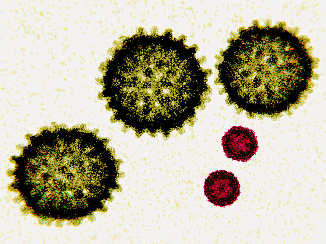 Hepatitis C and polio virus particles, illustration