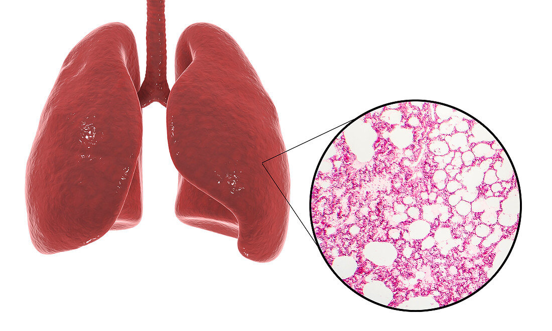 Human lung anatomy and histology, illustration