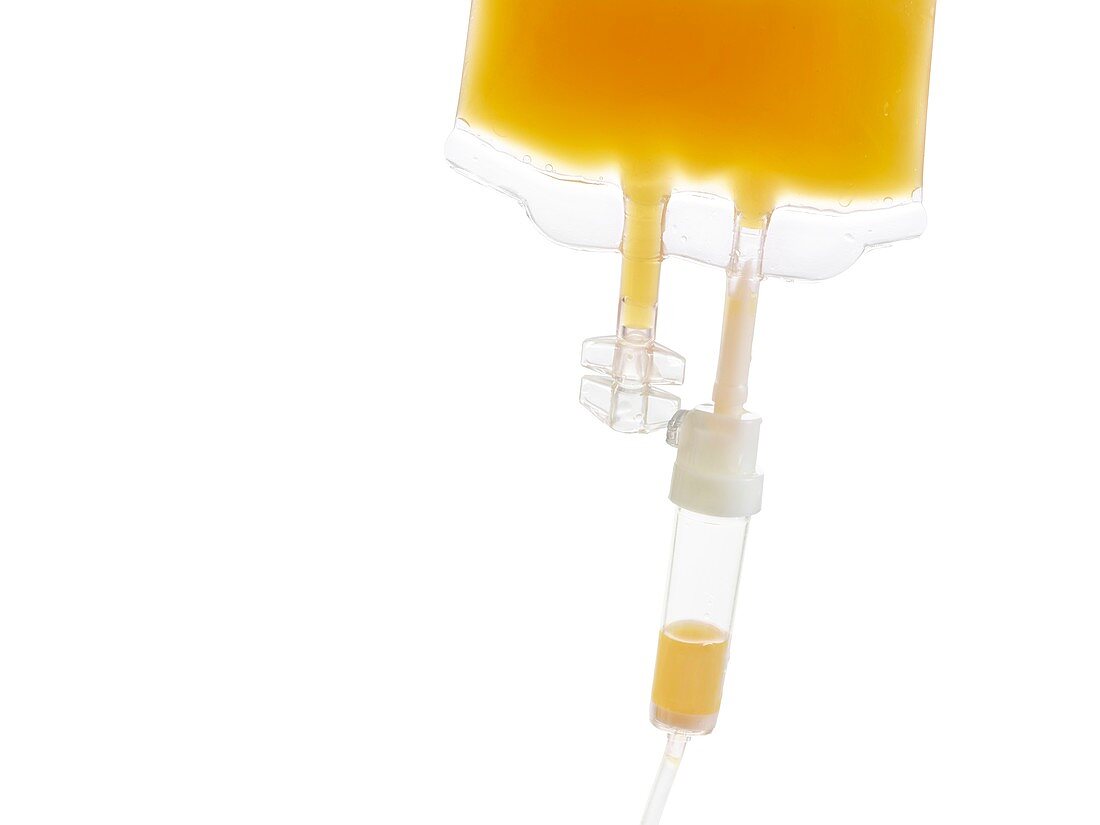 IV bag with orange juice