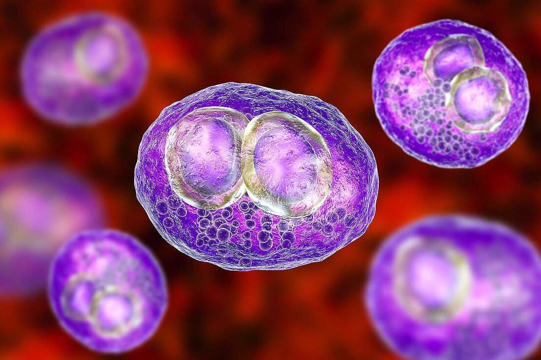Cytomegalovirus infection, illustration