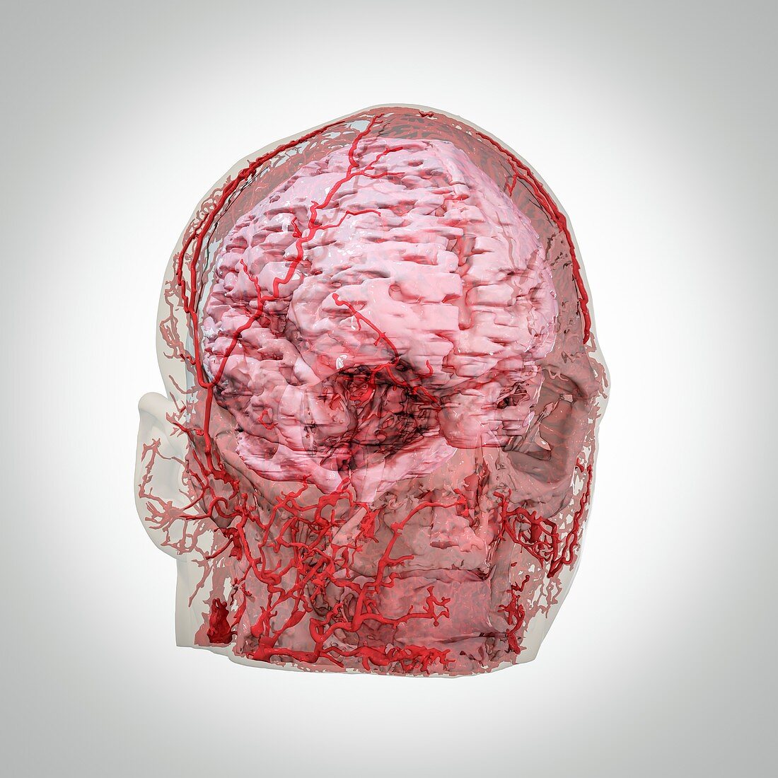 Human head and brain blood vessels, 3D CT scan